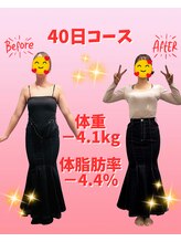 はぴねす整骨院/お腹周りをすっきりさせる