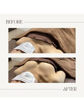 ラグレ(LUXRE)/バストケア