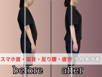 リベスト(RE:BEST)/スマホ首・猫背・反り腰矯正