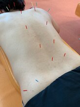 イワモト 水戸院(IWAMOTO)/背部全体調整