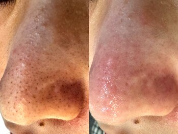 サイセイ(SAISEI)/