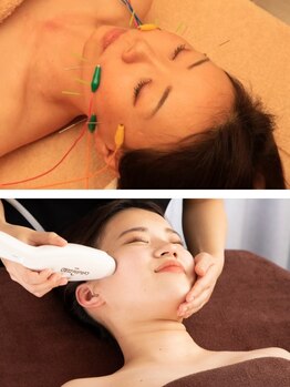 ベルシャ(Belle Chat)の写真/鍼施術×コルギ×最新機器でほうれい線・目のくま・たるみにアプローチ！スッキリ&生き生きしたお顔へ♪