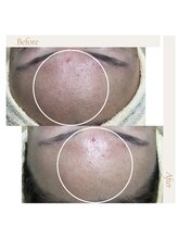 ファロンビューティー(fallon beauty)/お客様ビフォー×アフター