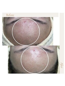 ファロンビューティー(fallon beauty)/お客様ビフォー×アフター