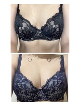 美人バスト 本厚木店/【バストアップ☆育乳】◇症例
