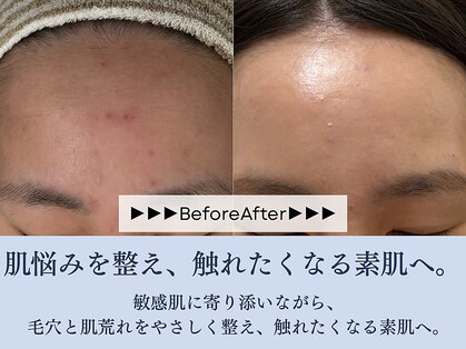 サロン コムモア(salon COMME MOI)の写真
