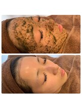 アイラッシュ ミル 御領店(eye lash Miru)/剥けないハーブピーリング効果