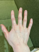 ナノハナ/鹿沼市の全身脱毛のナノハナ