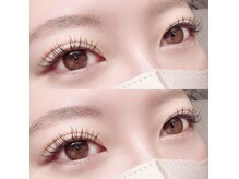 フーフロー(Fooflow)/フラットラッシュ140本