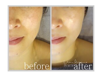 アン グレーヌ 自由が丘(unegraine)/内側から発光している様な艶肌に