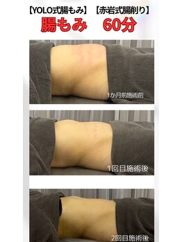 リア(Lia)/腸もみ 60分