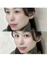 ミロバイキング 樟葉店(Milo by king)/［パーソナルラッシュリフト］