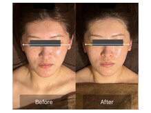 レーヴリゼ(Revelise)/頭蓋骨小顔矯正＋整顔マッサージ