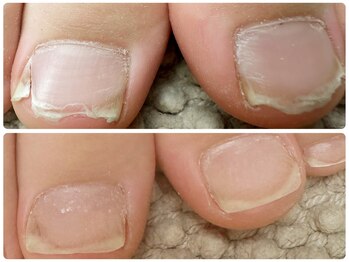 エン 武蔵新城店(en)/フット深爪や巻き爪に対応！