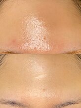 ソリッジ肌管理室/TIPサイエンスコントロール