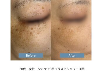 ビジュツ(BIJYUTSU)/