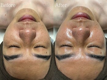 ルミナ シブヤ(LUMINA SHIBUYA)/【ダクトピール】1回目　正面