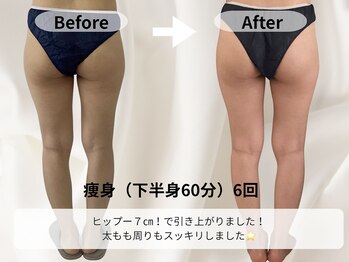 モア 星ヶ丘店(MORE)/お客様痩身ビフォーアフター