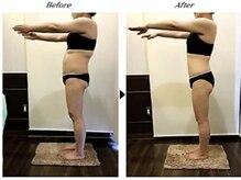 ビューティークリニックコダマ 宮崎本店/【2か月コース】M.N 様 （38歳）