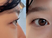 ユーロ(EURO)/マツパ／お客様デザイン