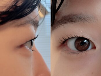 ユーロ(EURO)/マツパ/お客様デザイン