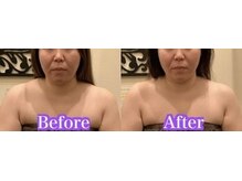 アジール 長岡リバーサイド千秋店(agir)/before/after画像