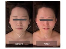 レーヴリゼ(Revelise)/頭蓋骨小顔矯正＋整顔マッサージ