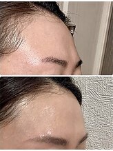 ワイズ 沖縄うるま院(Medical Y's)/脂肪増殖