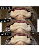 リノレア(LinoLea)/