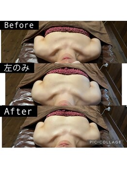 リノレア(LinoLea)/