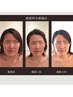 技術力の高さが人気◎《この技術を求めて遠方からも多数♪☆》頭蓋骨小顔矯正