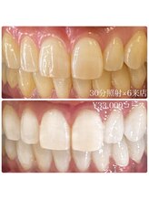 ホワイトニングルーム 横浜店(Whitening Room)/ホワイトニング/横浜