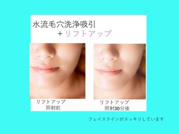 リュクス(LUXE)/ビフォーアフター