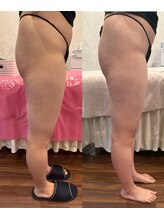 ブリア 横浜(BRILLA)/DETOXソルトでリンパマッサージ