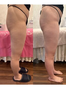 ブリア 横浜(BRILLA)/DETOXソルトでリンパマッサージ