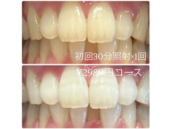 ホワイトニングルーム 横浜店(Whitening Room)/セルフホワイトニング/横浜