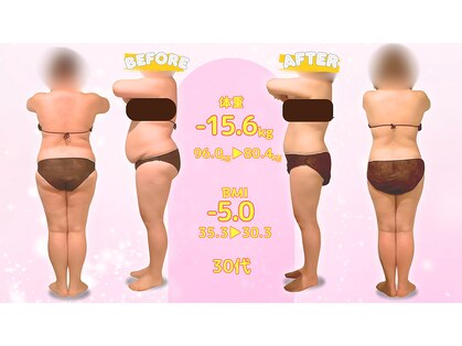 プラスボディレボリューション(+Body Revolution)の写真