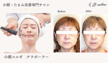 ビーサロン(B-salon)