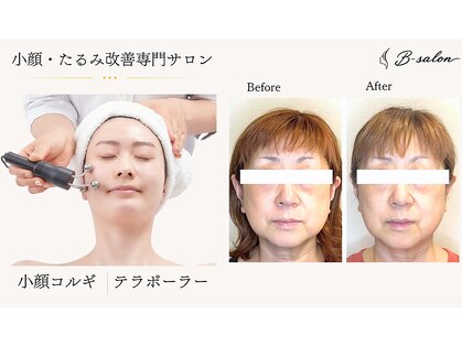 ビーサロン(B-salon)の写真