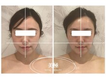 美極 銀座店/銀座/小顔コルギ/小顔矯正