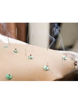 首・肩のつらさを改善したい