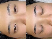 レアファースト