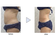 都度払いサロン Clear＋ 泡瀬店【クリアプラス】脱毛/フェイシャル/痩身/バストケア/エルフィーノ痩身