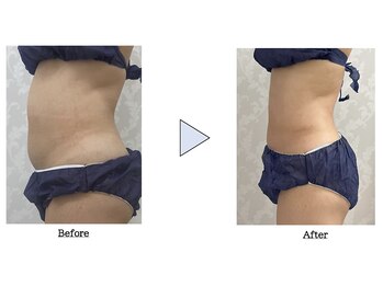 都度払いサロン Clear+ 泡瀬店【クリアプラス】脱毛/フェイシャル/痩身/バストケア/エルフィーノ痩身