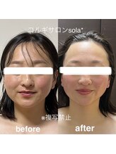 ソラ(sola*)/フォトウェディングに向けて