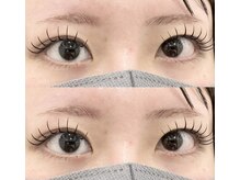 バニーアイズ 天神(Bunny eyes TENJIN)/フラット100本