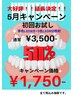 【半額キャンペーン】業界初80Wホワイトニング