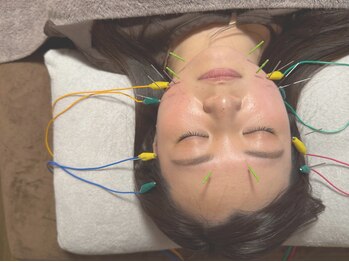 asmot鍼灸 整体院 代々木上原(asmot鍼灸 整体院)の写真/美容鍼＋頭皮・首にアプローチで首や眼精疲労スッキリ解消♪目元パッチリ＆頭スッキリ◎