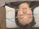 asmot鍼灸 整体院 代々木上原(asmot鍼灸 整体院)の写真/美容鍼＋頭皮・首にアプローチで首や眼精疲労スッキリ解消♪目元パッチリ＆頭スッキリ◎
