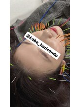 ハリシェンド/100本美容鍼電気付きメニュー